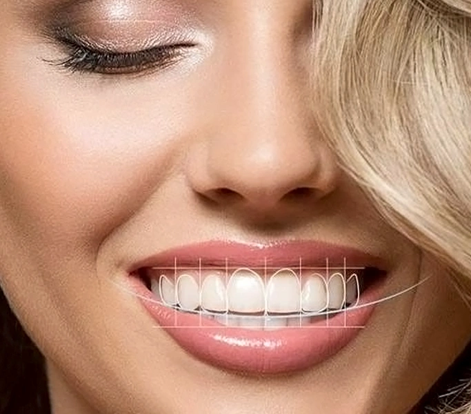 SMILE DESIGN