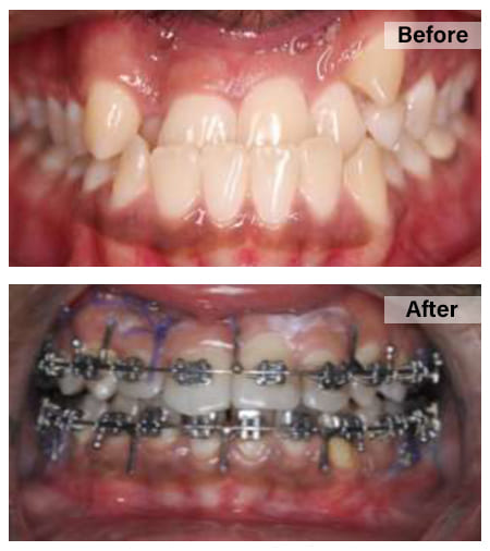 Orthodontics1