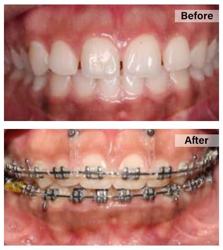 Orthodontics2