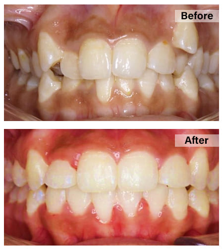 Orthodontics3